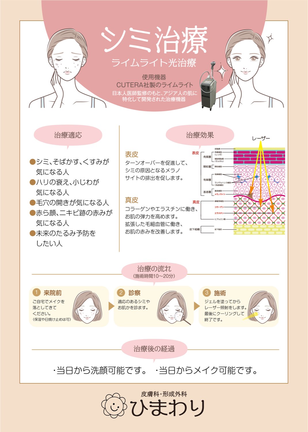 シミ治療 — 治療内容