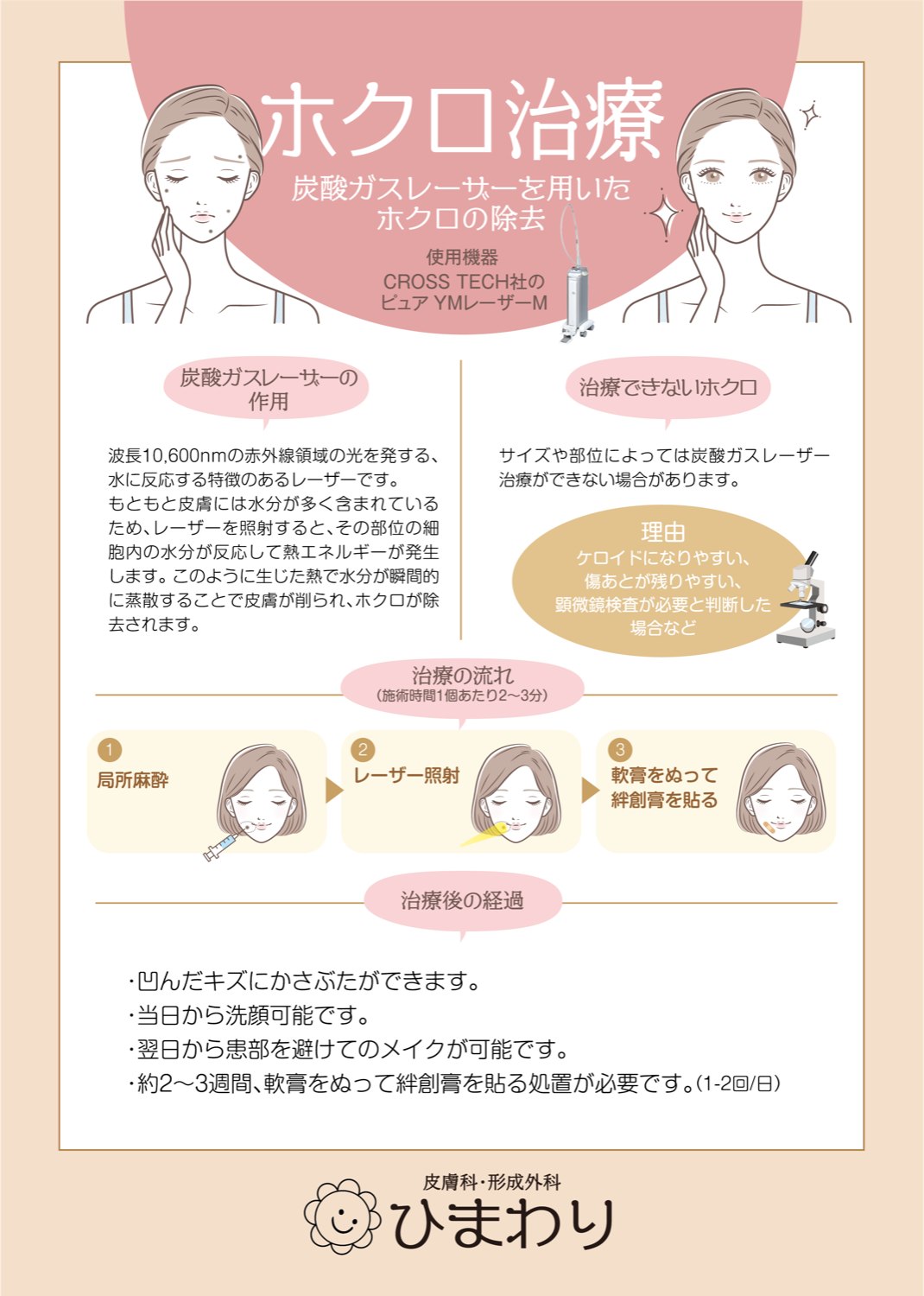 ホクロ治療 — 治療内容